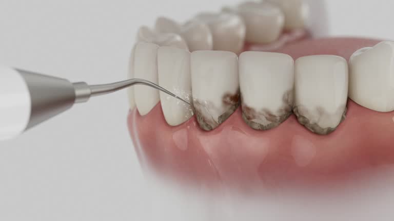Reliable Dental contractor in Keuka Park, NY by Dentist Open Now